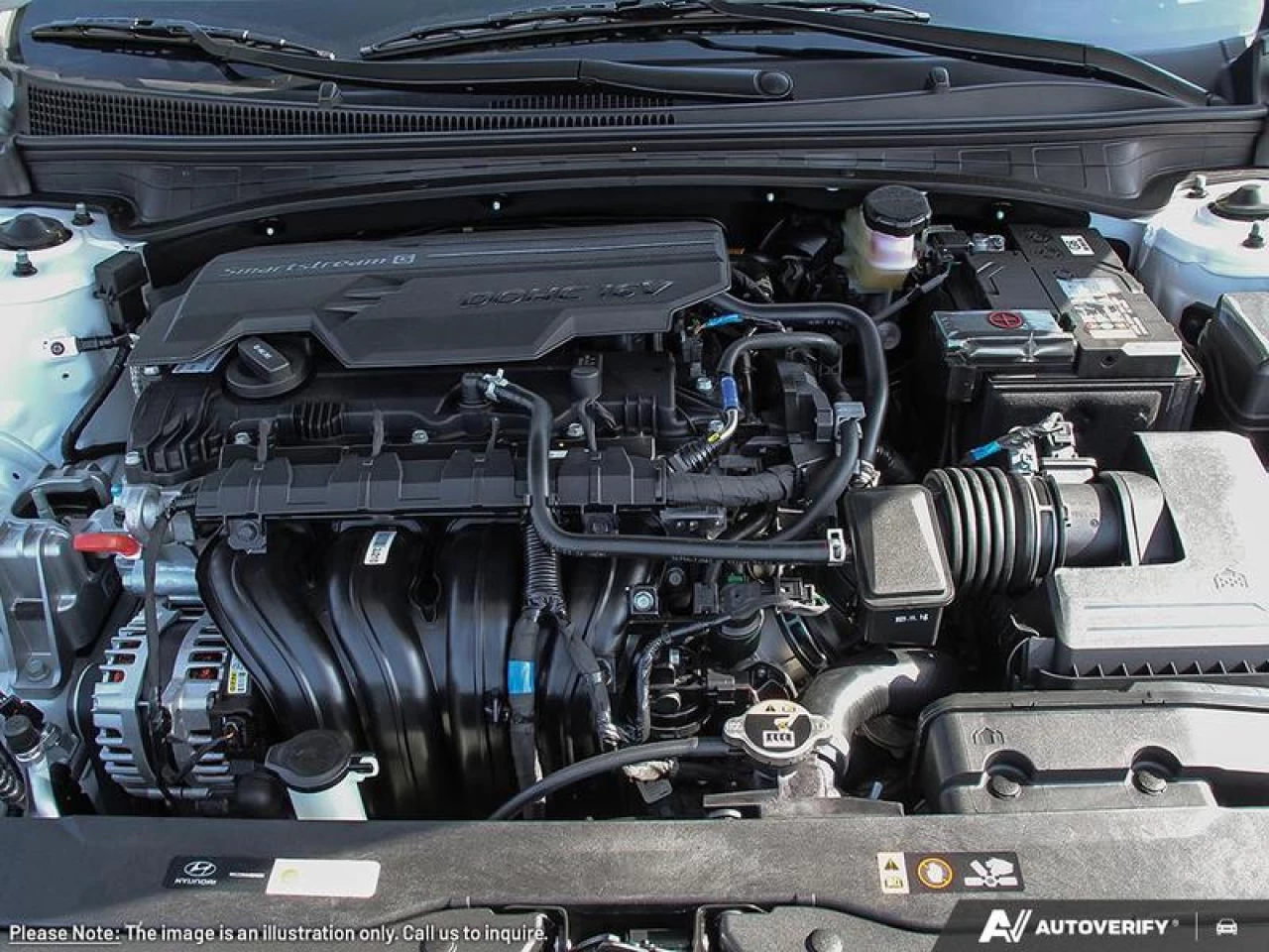 2025 Hyundai Elantra Luxury IVT Main Image