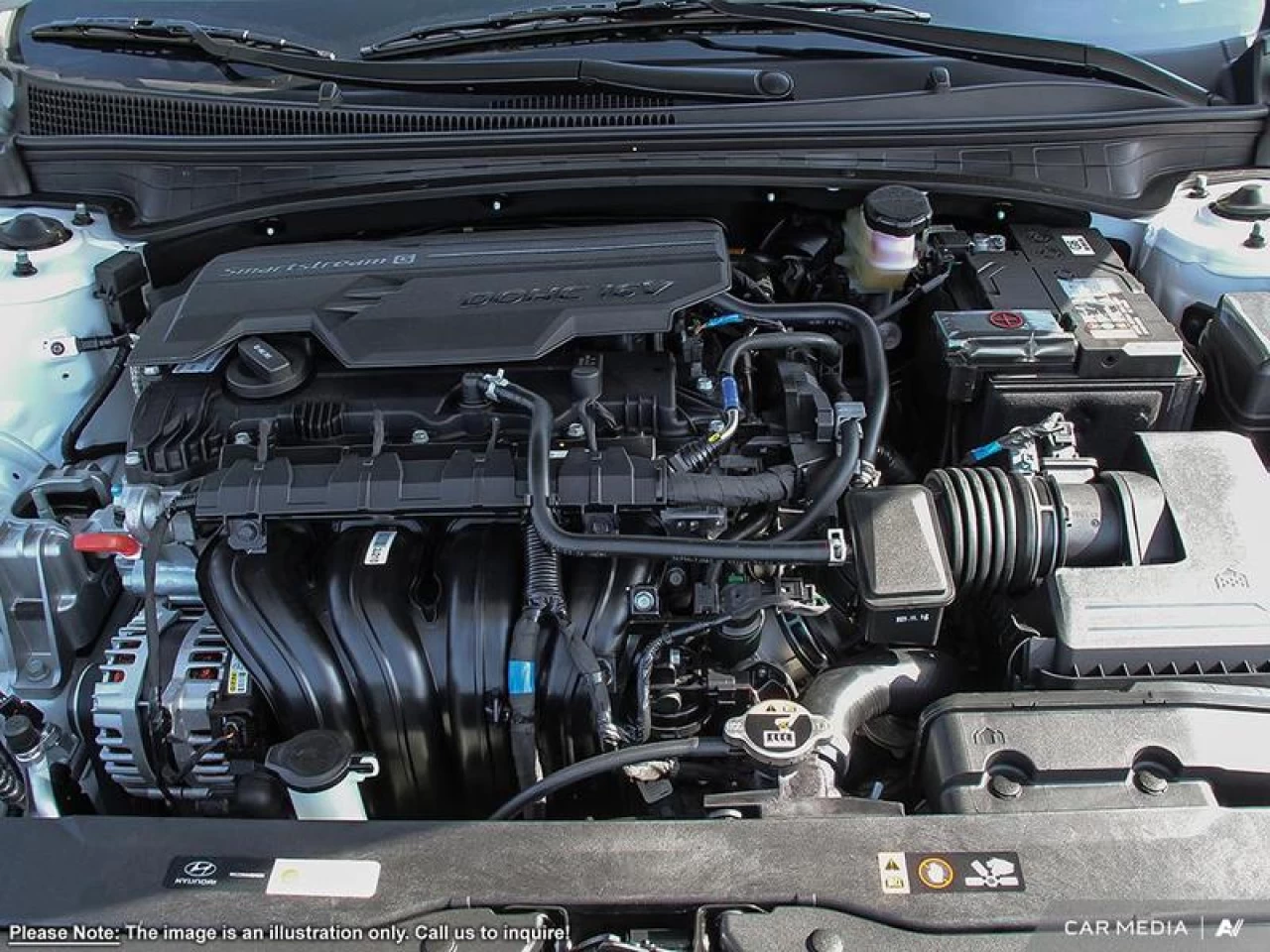 2025 Hyundai Elantra Luxury IVT Main Image